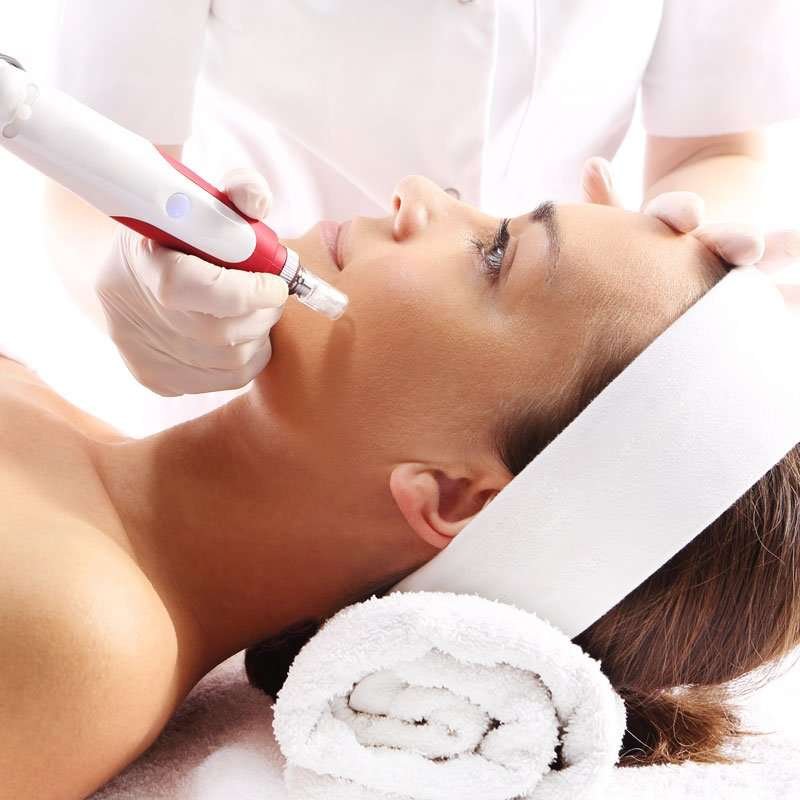 Bella Line – Microneedling
